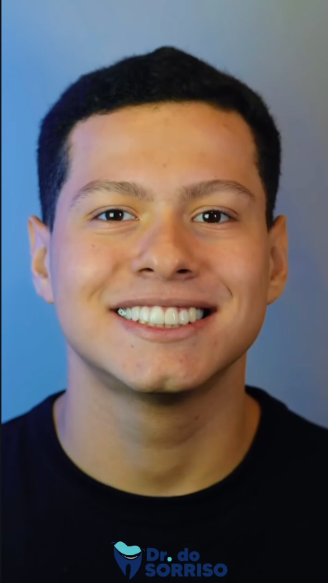 Sorriso Transformado