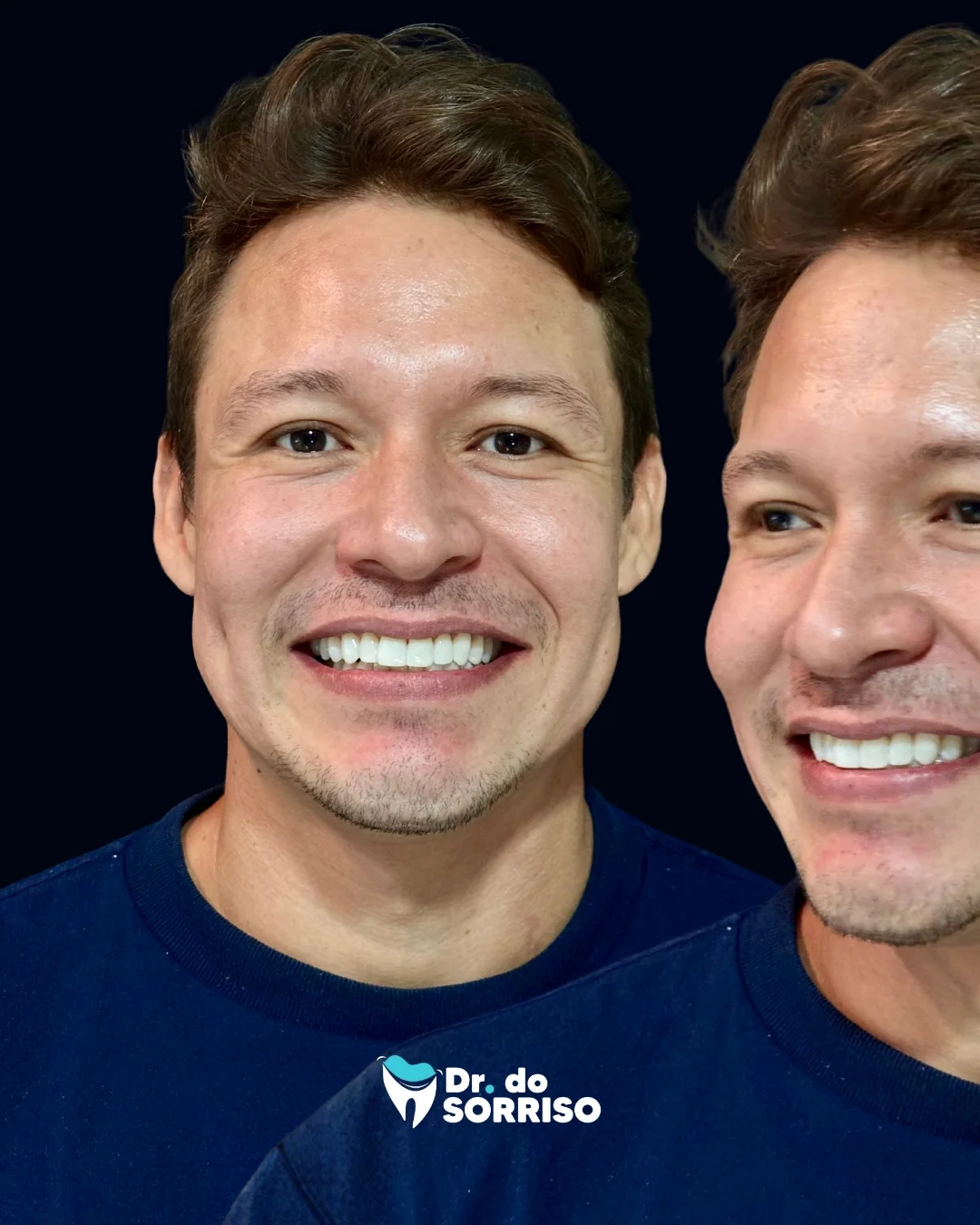 Paciente sorrindo após tratamento estético