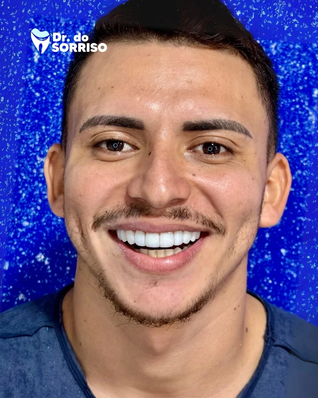 Paciente com sorriso renovado